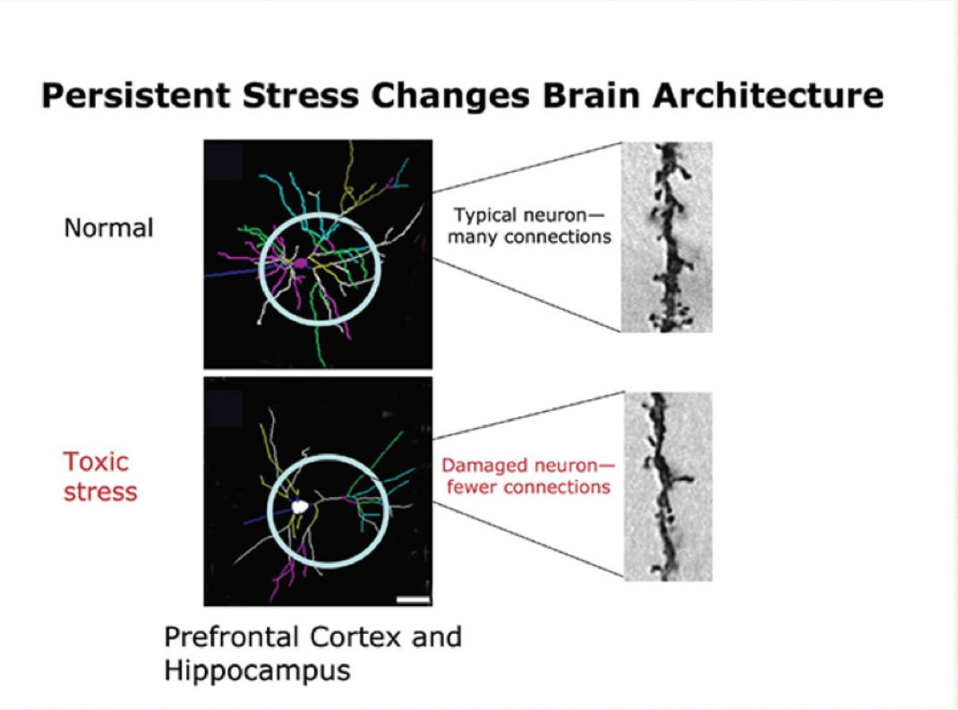 Diagram: persistent stress alters prefrontal cortex and hippocampus architecture