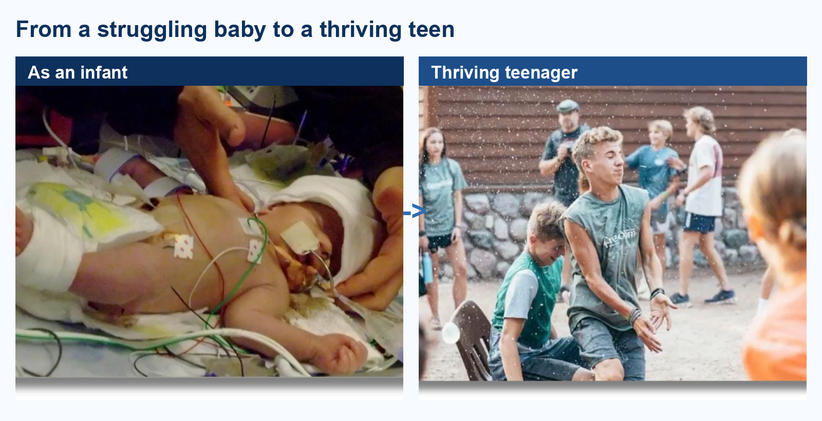 Dr. Tony Ebel's son Oliver as a struggling infant and as a thriving teenager