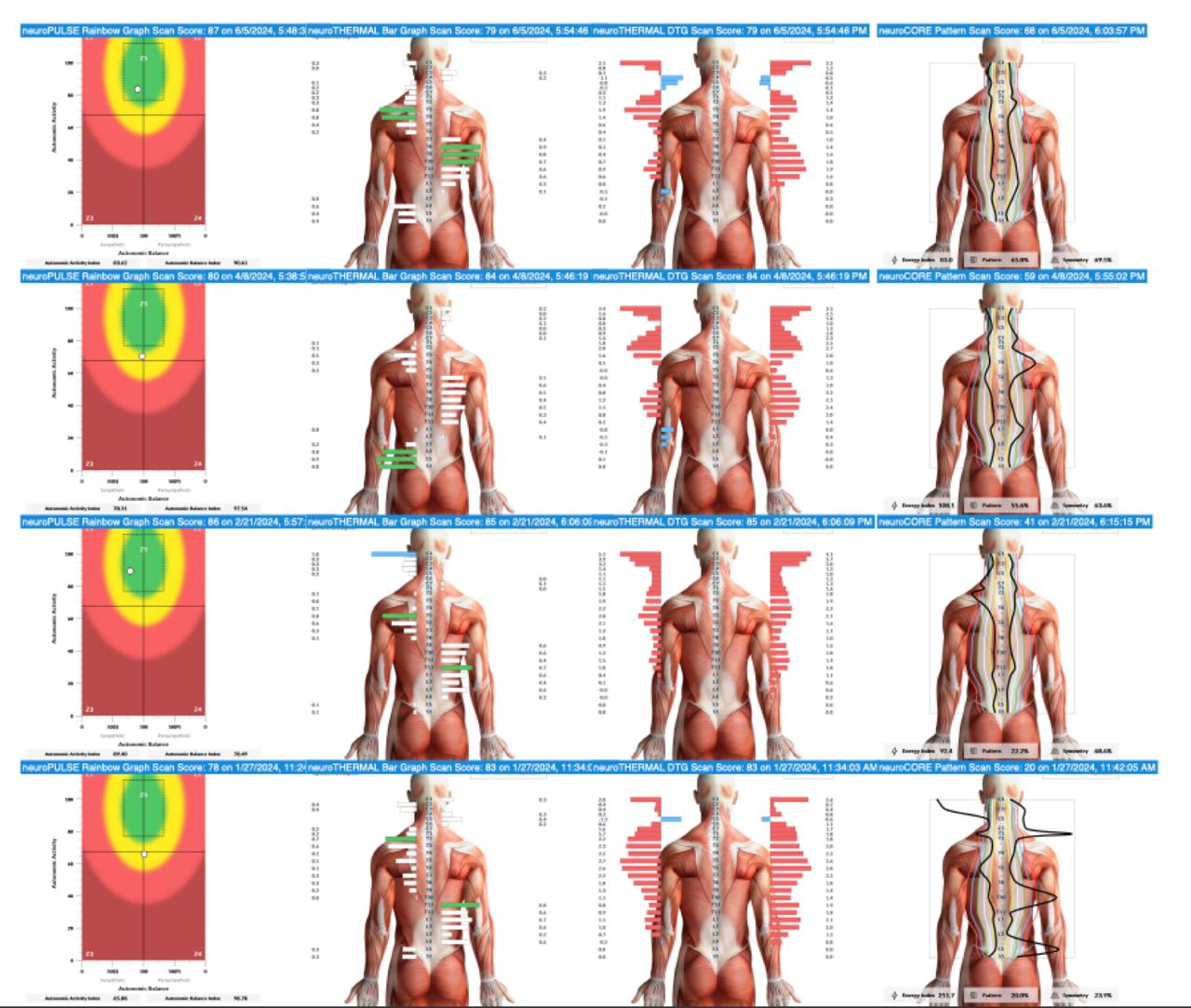 Case-example scan series