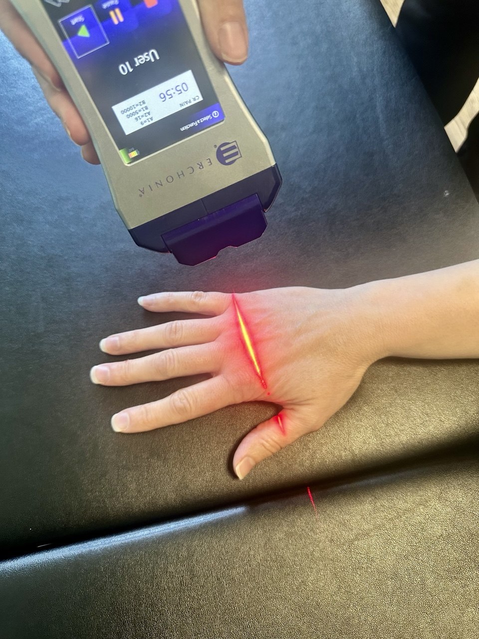 Cold laser in use during care